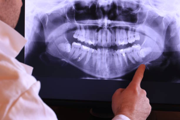 Best Emergency Root Canal Treatment in Clearwater, KS