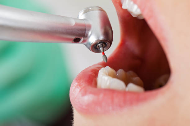 Best Weekend Emergency Dentist in Clearwater, KS